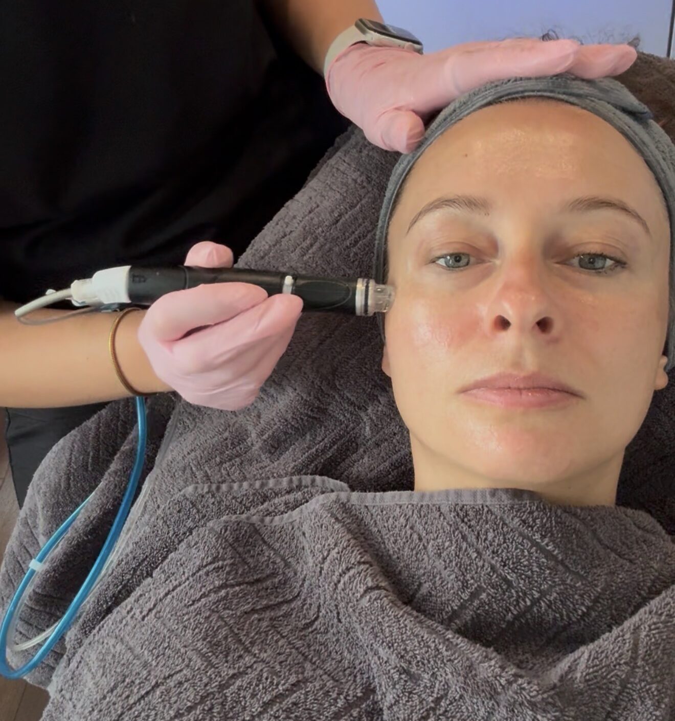 Kate testet: HydraFacial – mein Summer Glow bei Perfect Skin Berlin